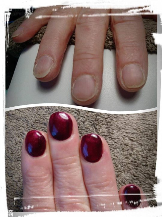 Medische pedicure, Nagelverzorging, Voetverzorging, Gellak, Gelaatsverzorging, Nagelbeugels in Itegem, Antwerpen
