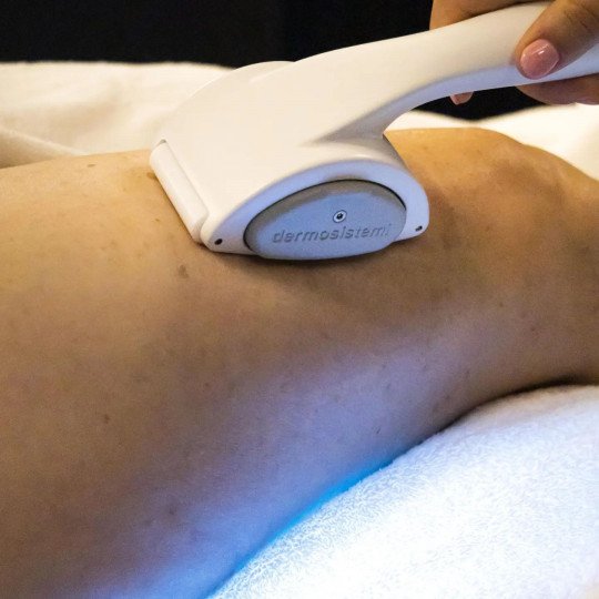 Cellulite behandeling bovenbeen Nazareth, Oost-Vlaanderen